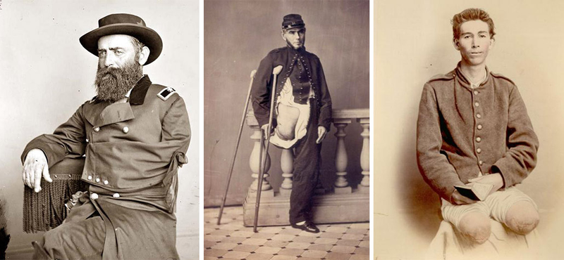 Illustration for article titled The Fascinating Untold History of War and Prosthetics